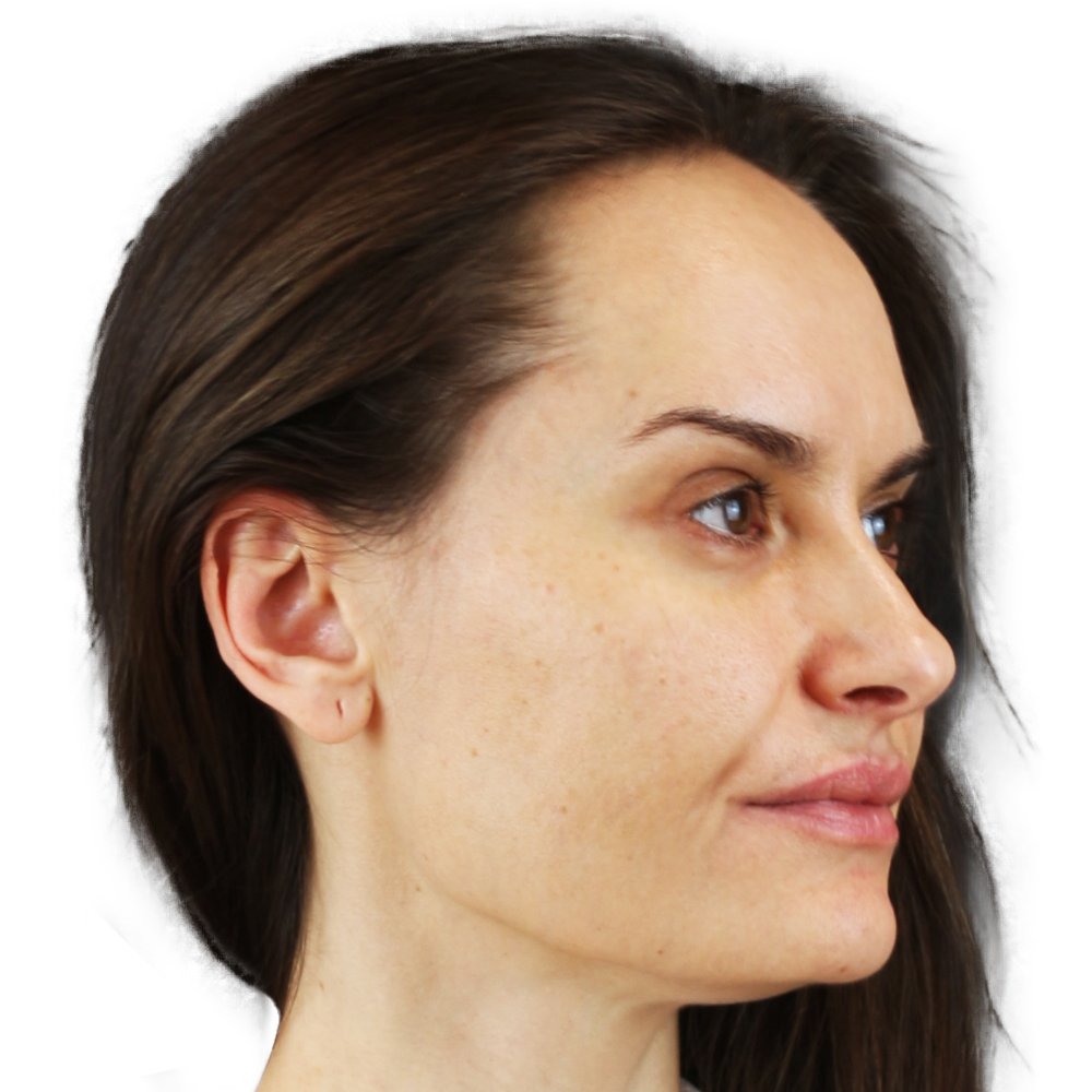Before-facetwo