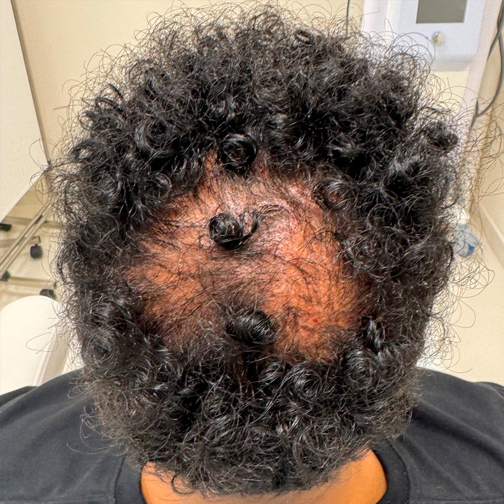 Before-facefive