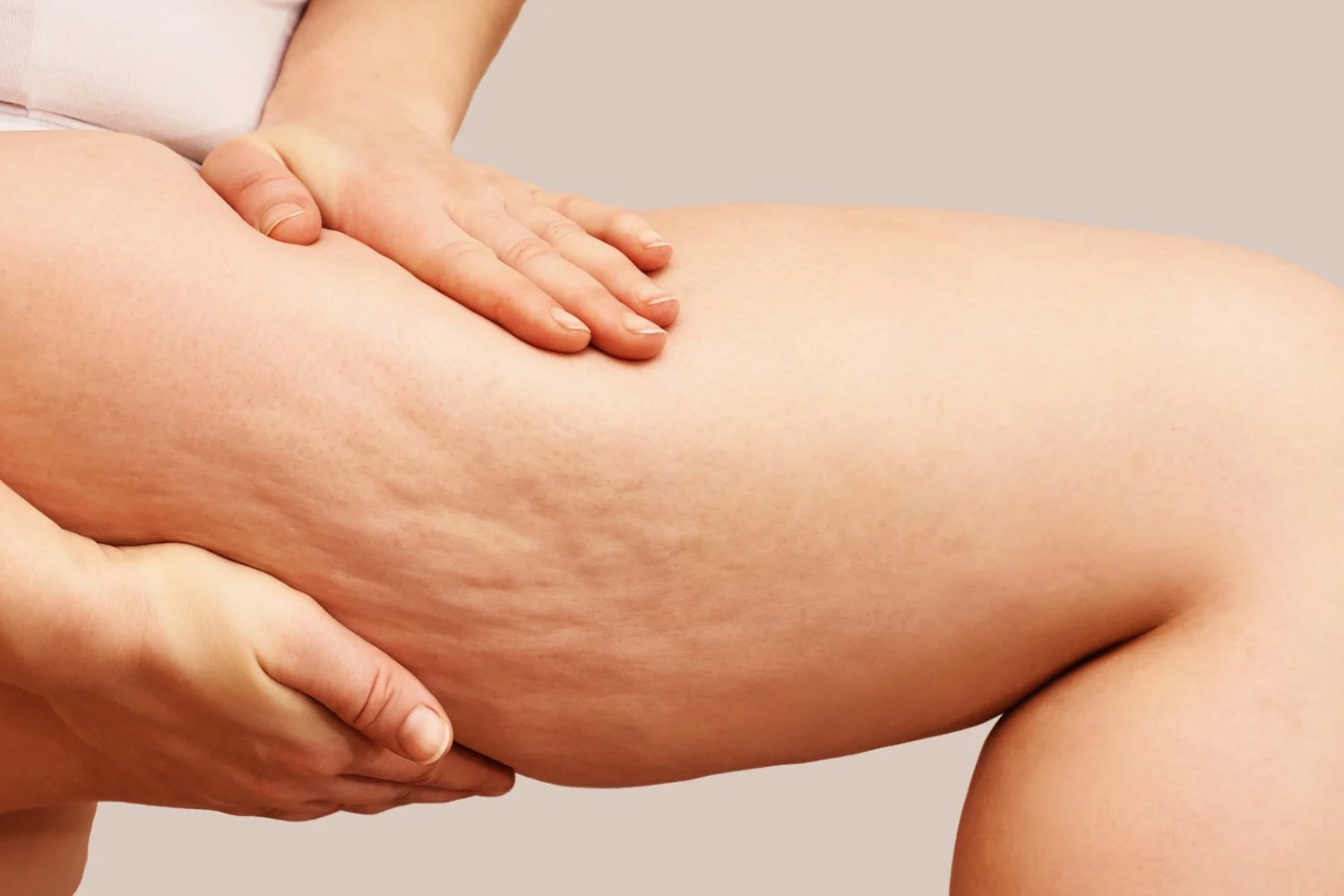 cellulite reduction cellulite-reduction