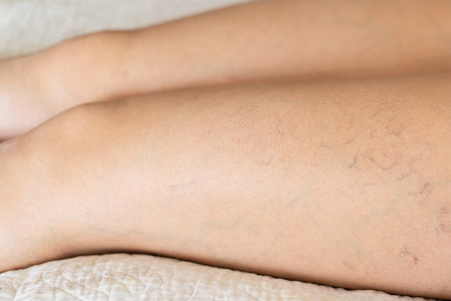 VASCULAR treatment VASCULAR treatment